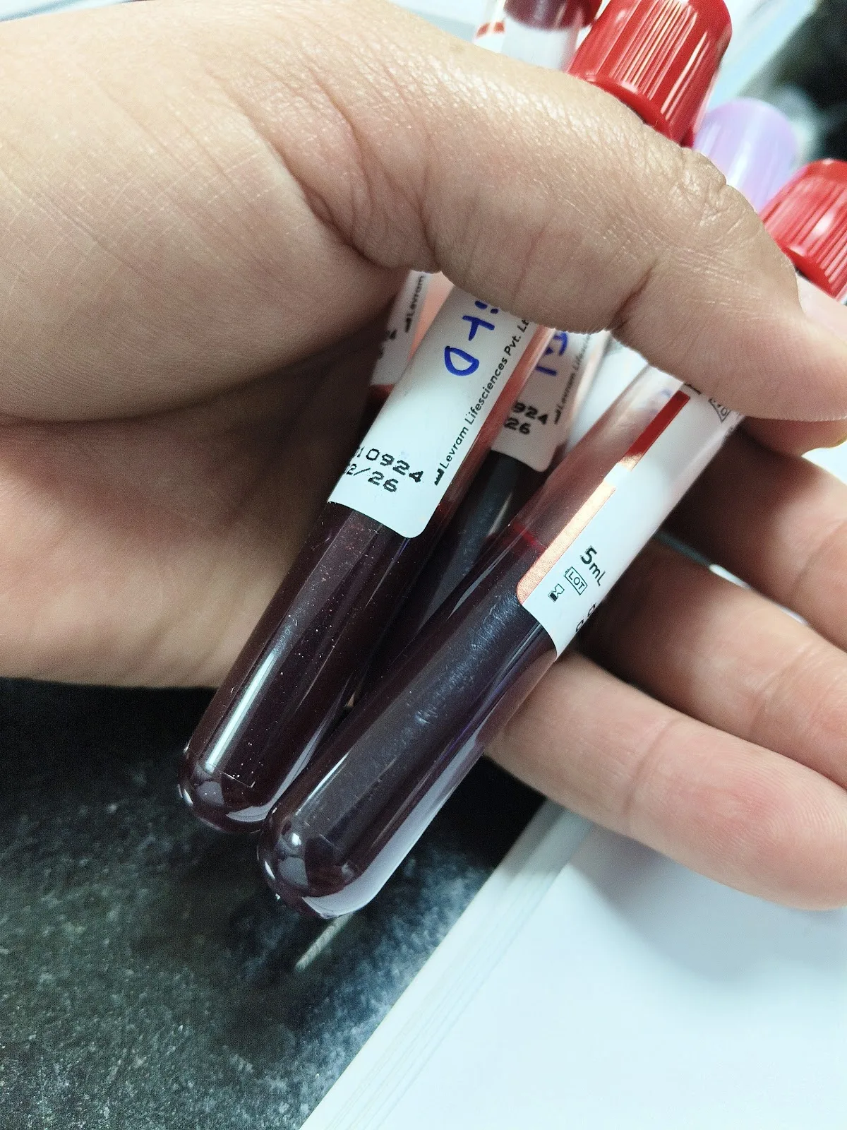 INS - Ashwini Blood Bank