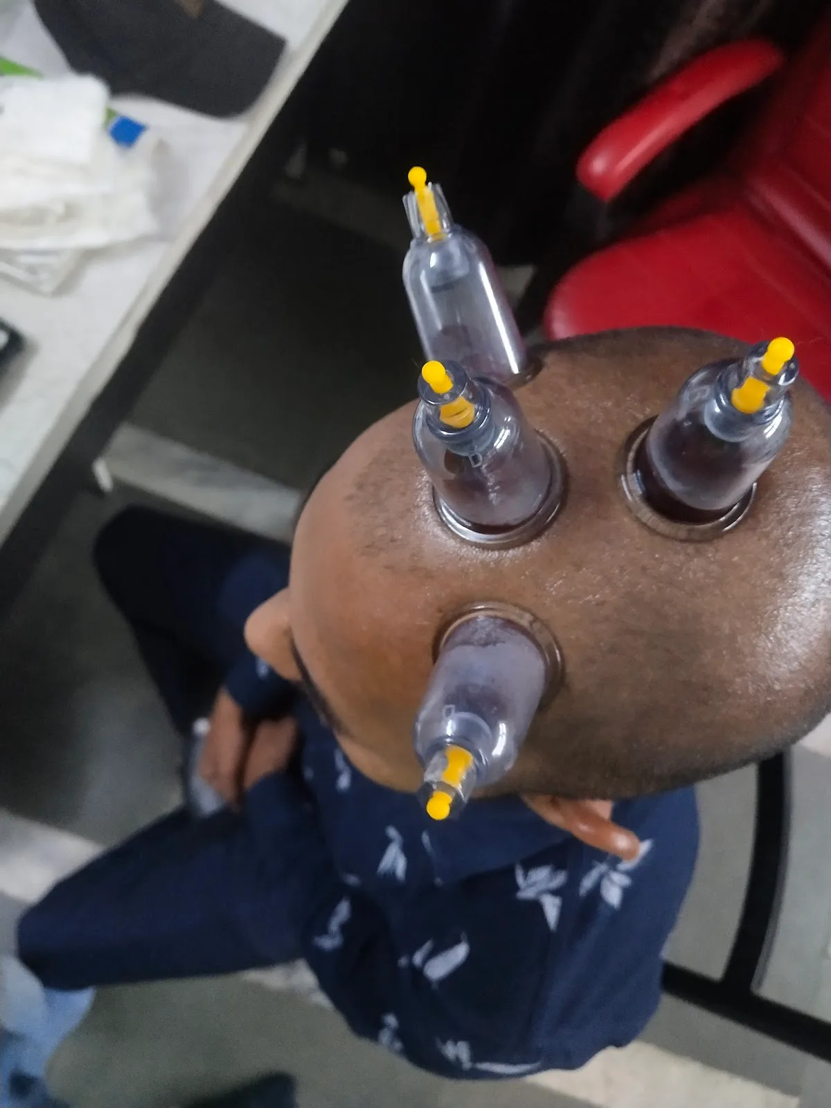 India Physiotherapy & Anaya HIjama Centre