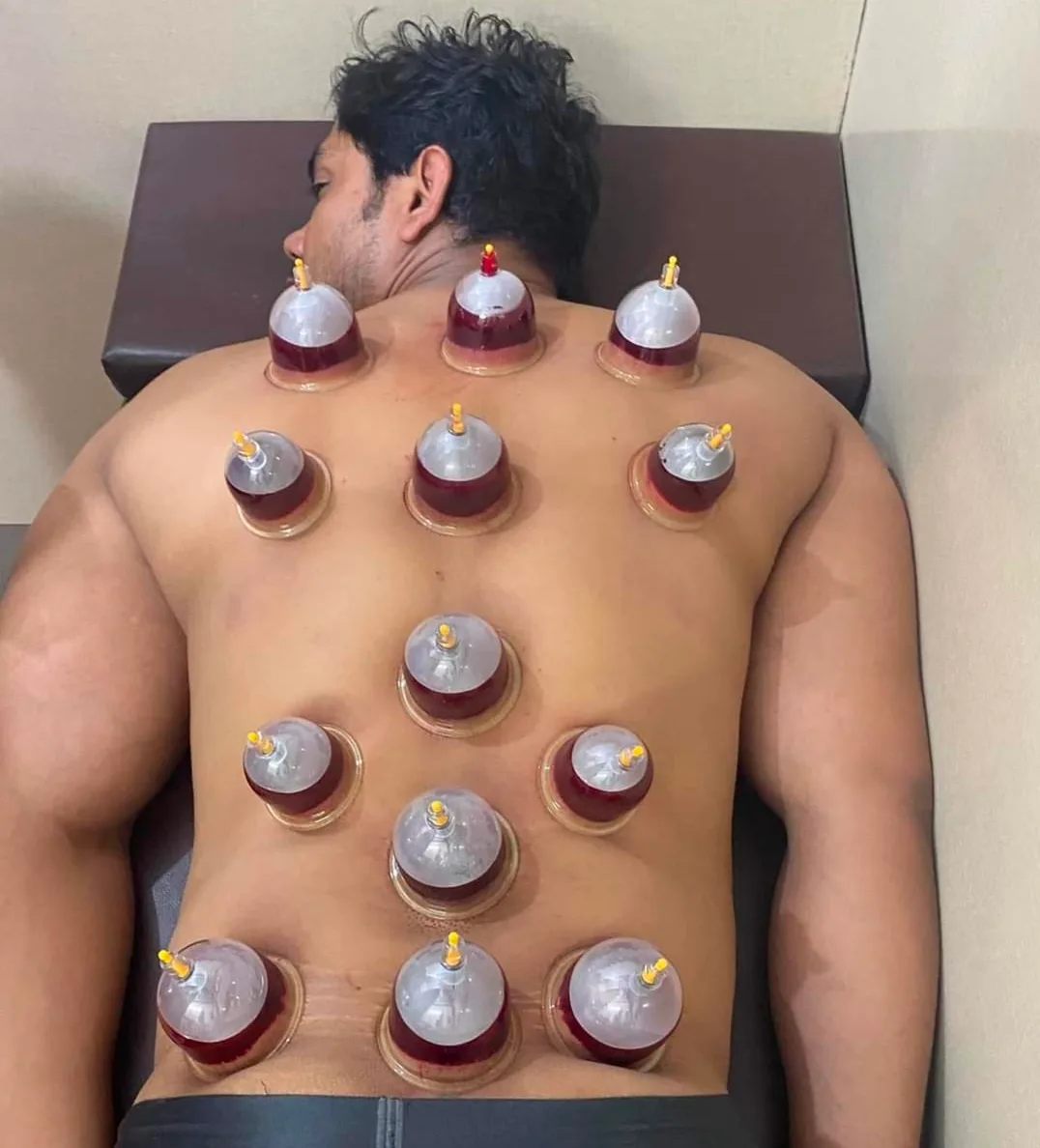 India Physiotherapy & Anaya HIjama Centre