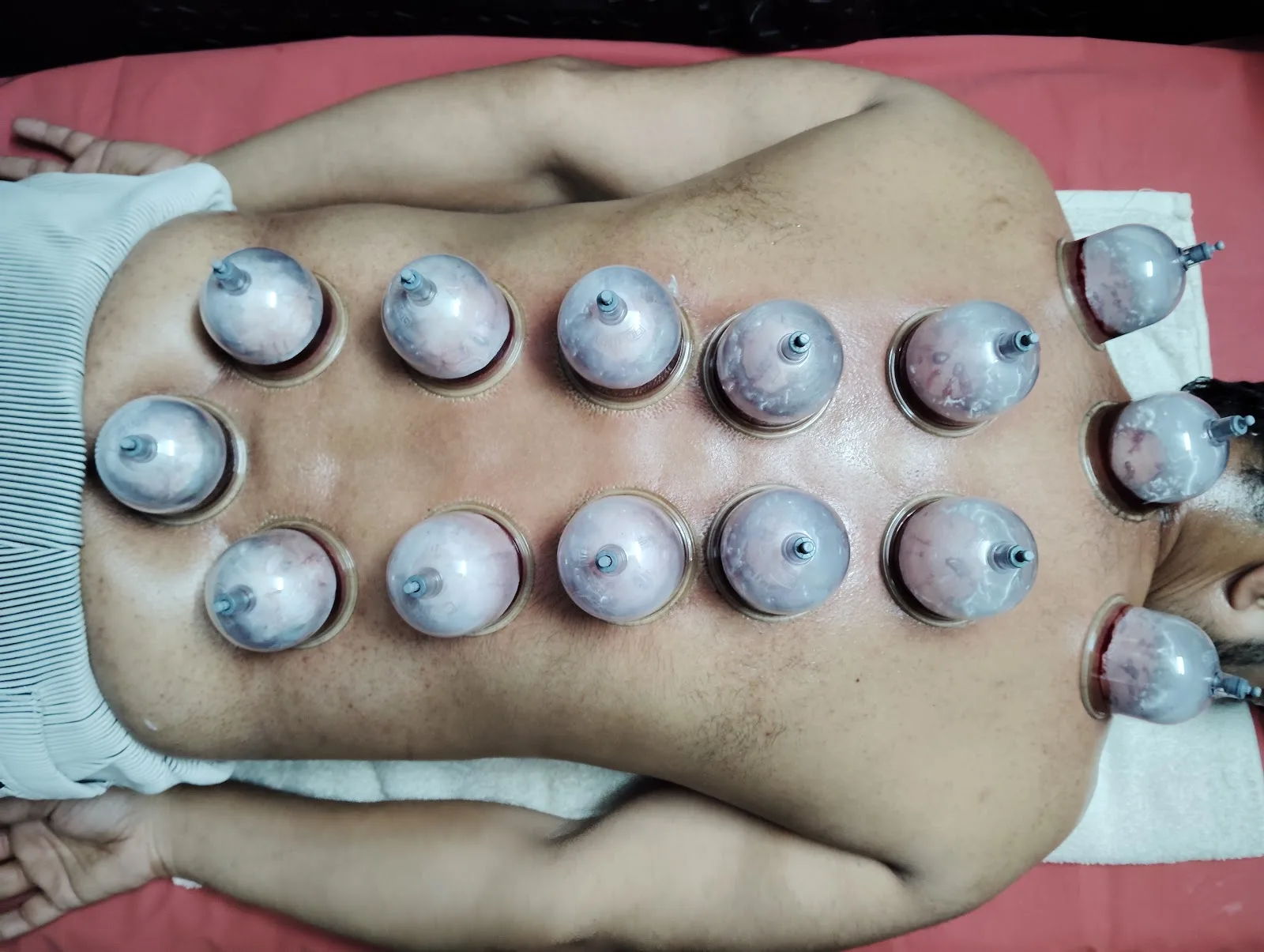 India Physiotherapy & Anaya HIjama Centre