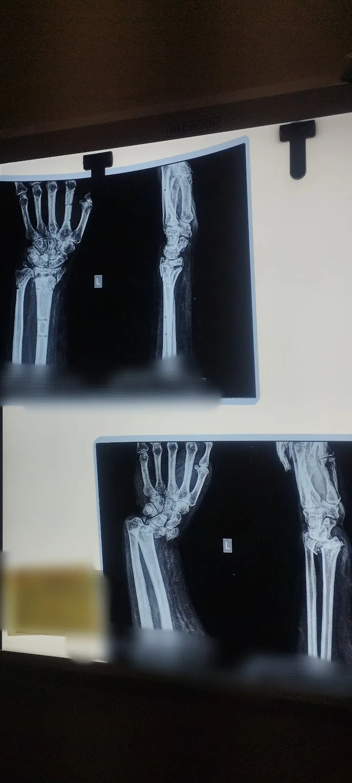 PhysioWellCare Clinic - ORTHO-NEURO-SPORTS INJURIES