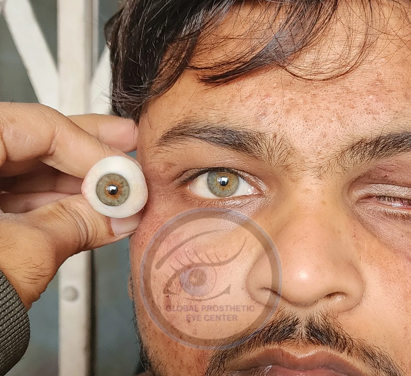 Global Prosthetic Eye Center