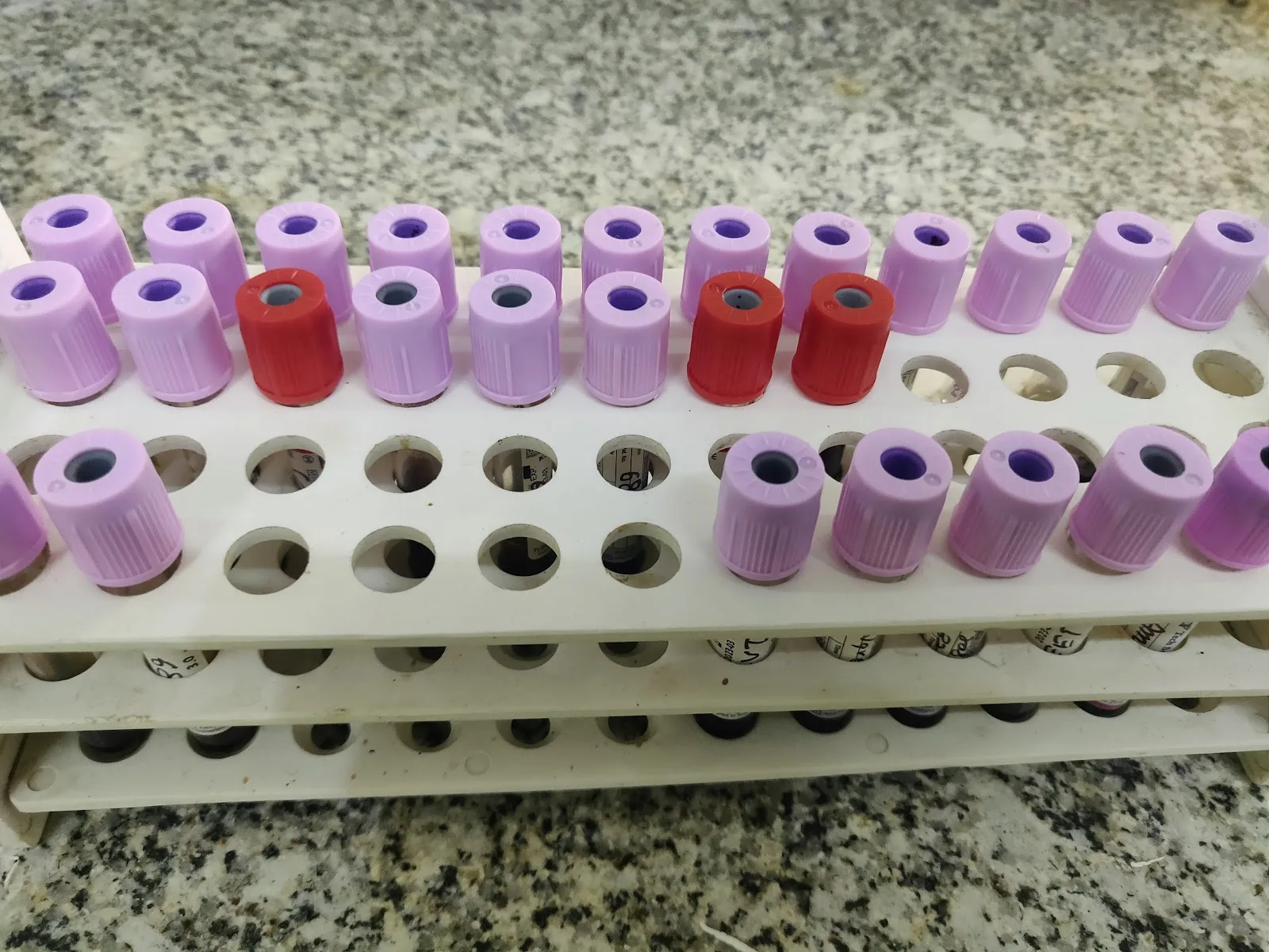 BLOOD BANK