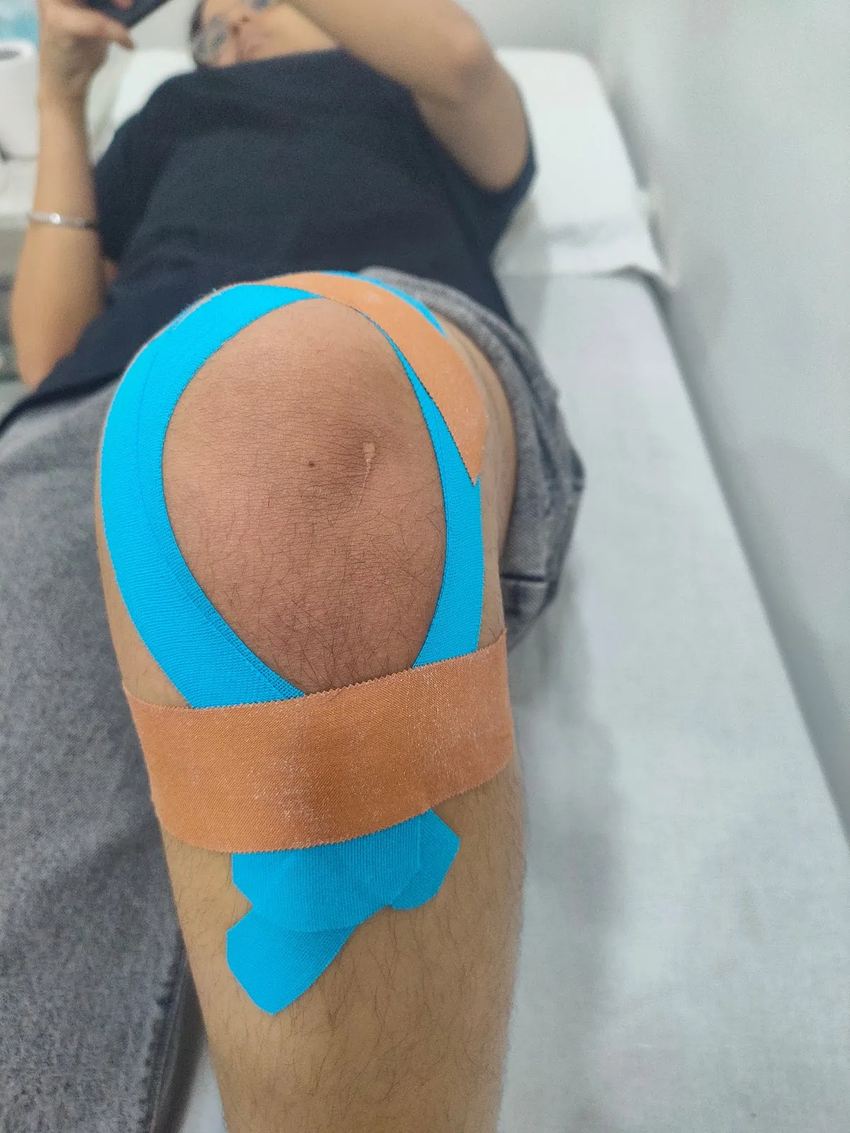 Physio Health Clinic : Physiotherapist in Jangpura, Bhogal | Best Physiotherapist in Jangpura Delhi