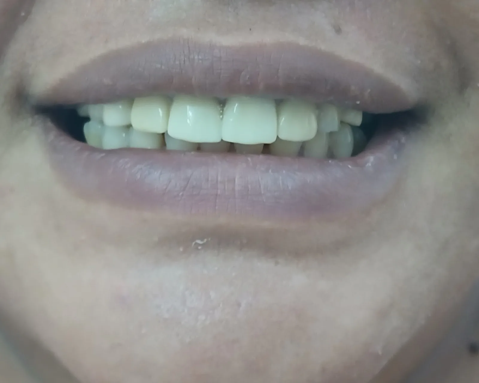 Karol bagh charitable dental Clinic