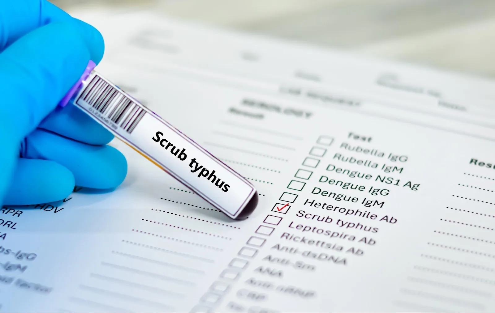 MaxAtHome Blood Test Lab | Full Body Health Checkup | Urgent Blood Test