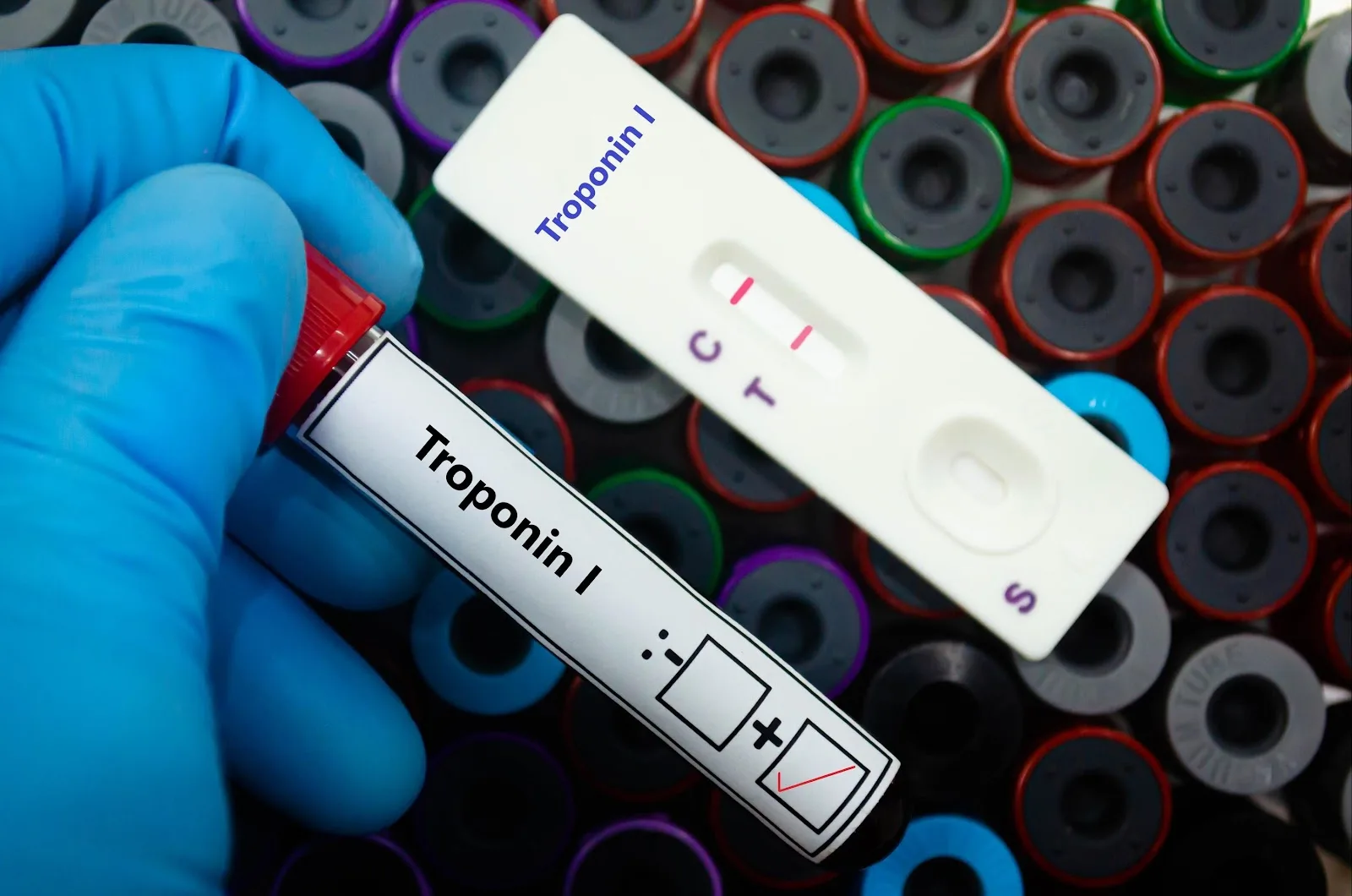 MaxAtHome Blood Test Lab | Full Body Health Checkup | Urgent Blood Test